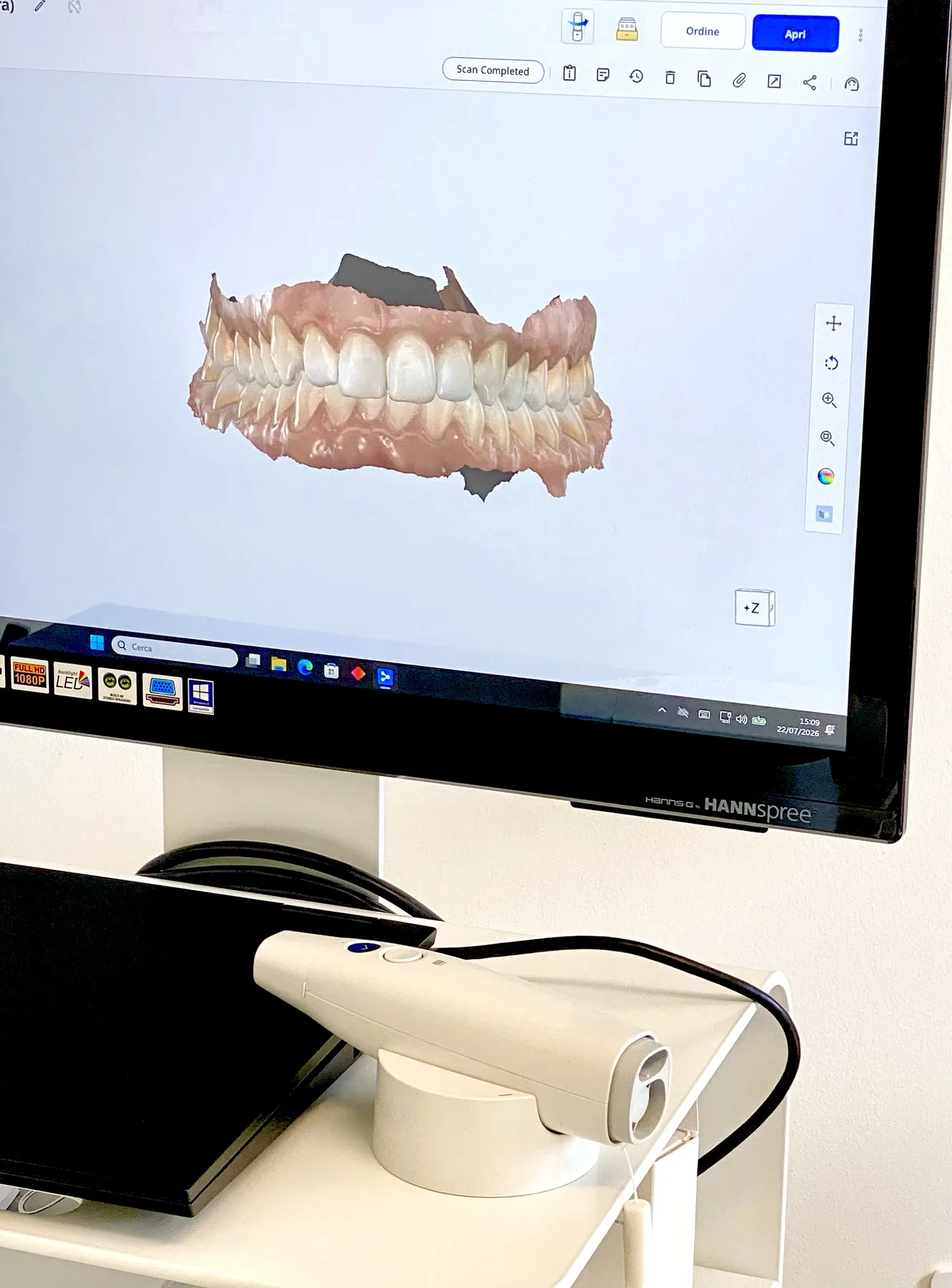 Scansione 3D dell'arcata dentaria sul monitor dello scanner intraorale
